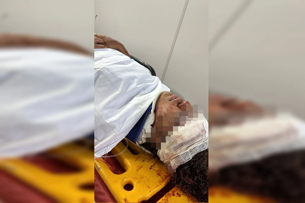 Atropelamento no Riacho Fundo: Jovem Vítima de Ação Cruel e Imprudente