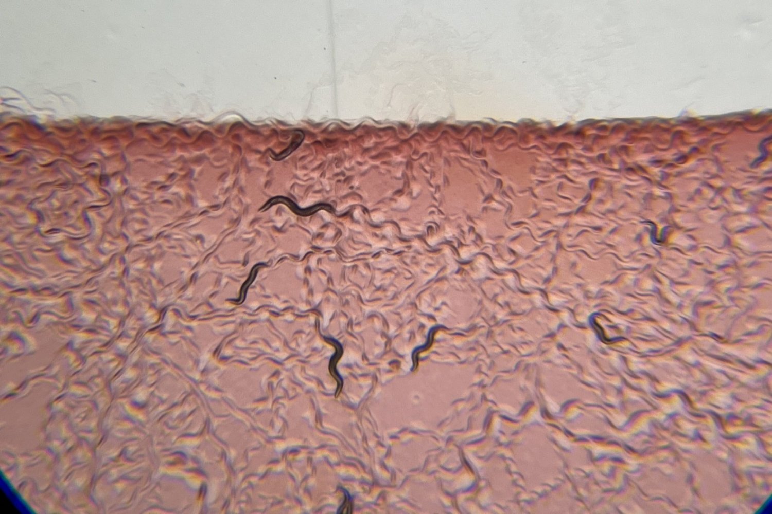 Como os neurônios Sentem Bactérias no Intestino