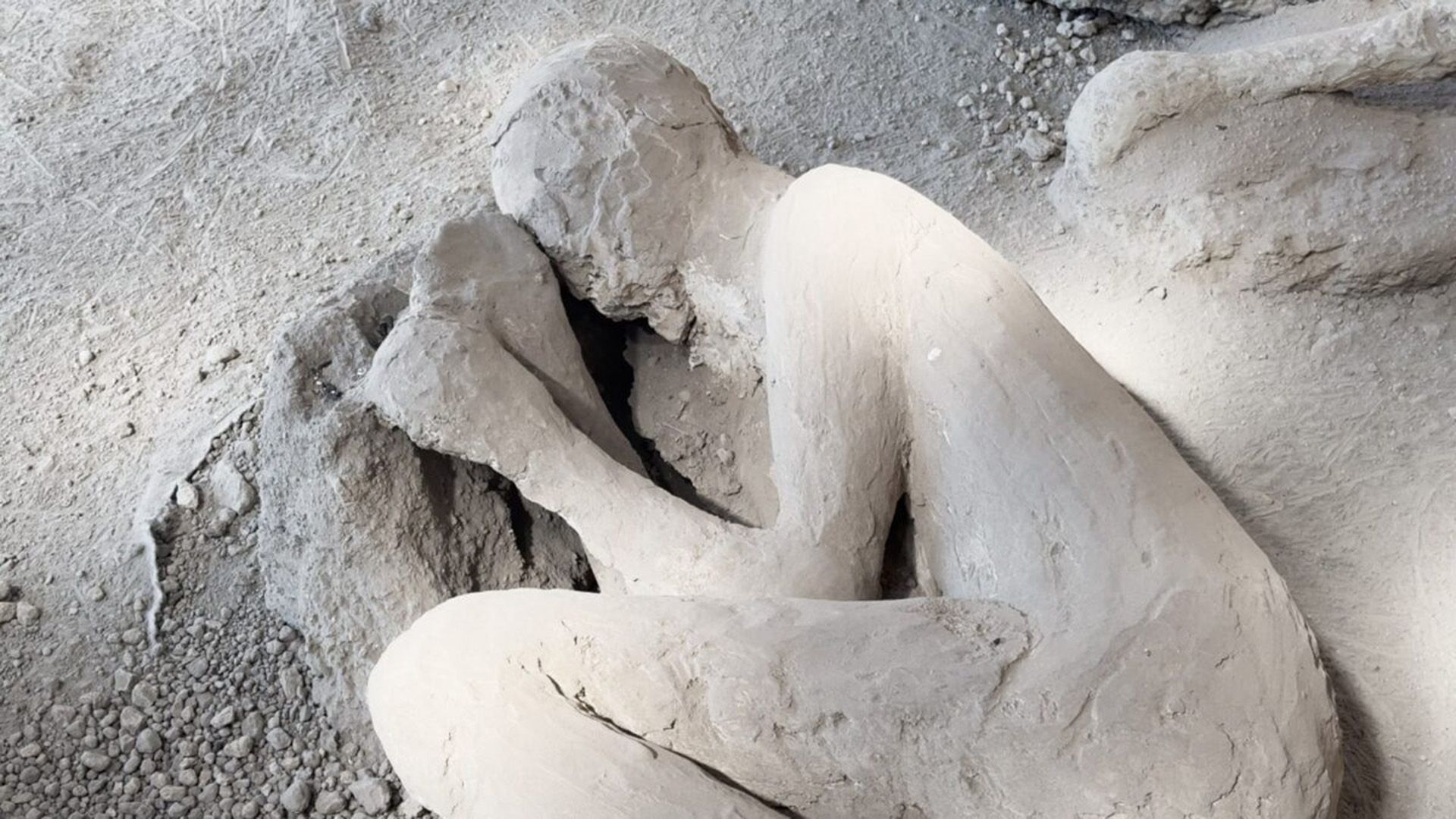 Descoberta de um Kit Médico na Vitima da Erupção do Monte Vesúvio em Pompéia