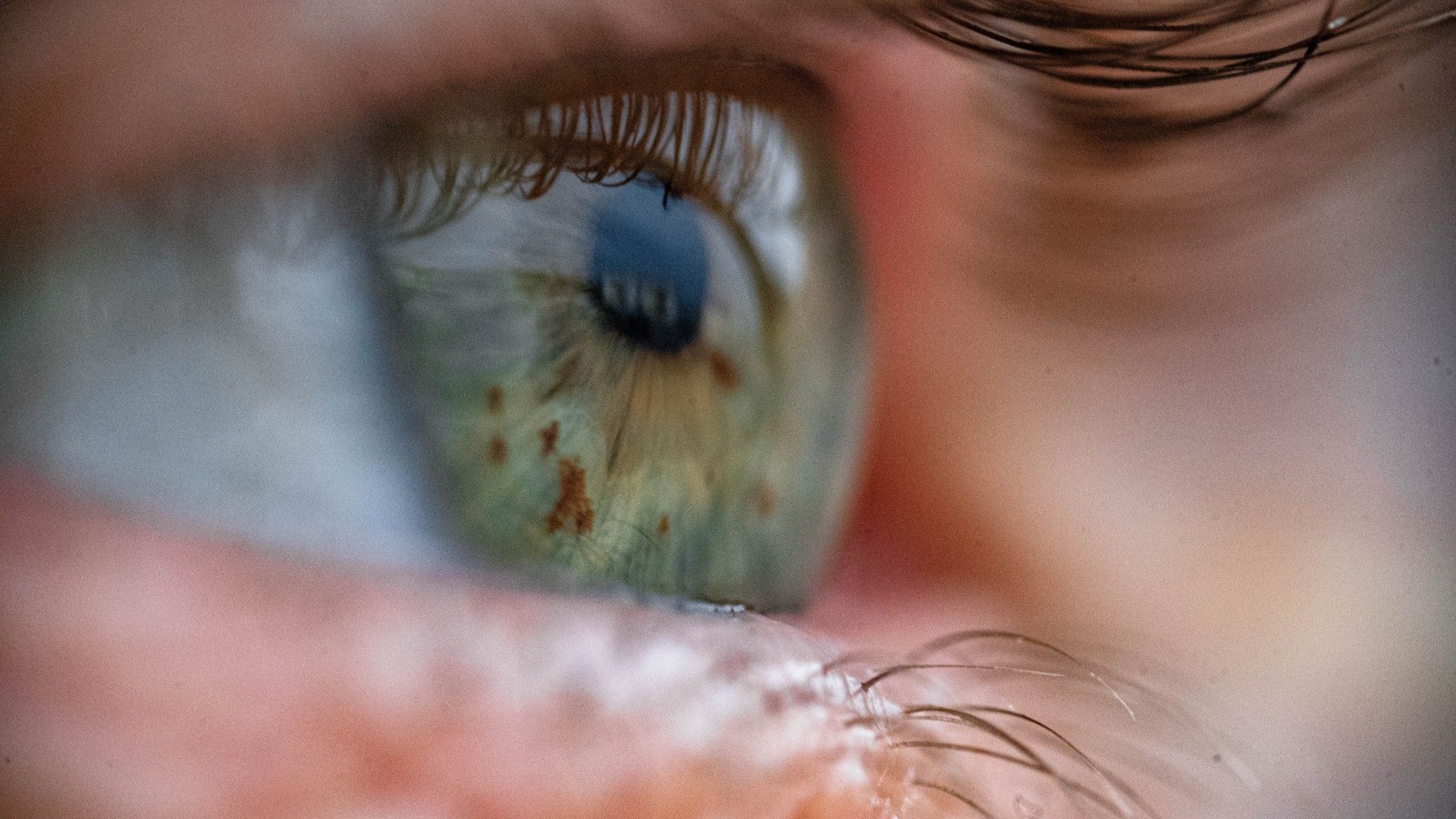 Revolução Diagnóstica: Teste que Avalia Anemia Usando Vídeos dos Olhos