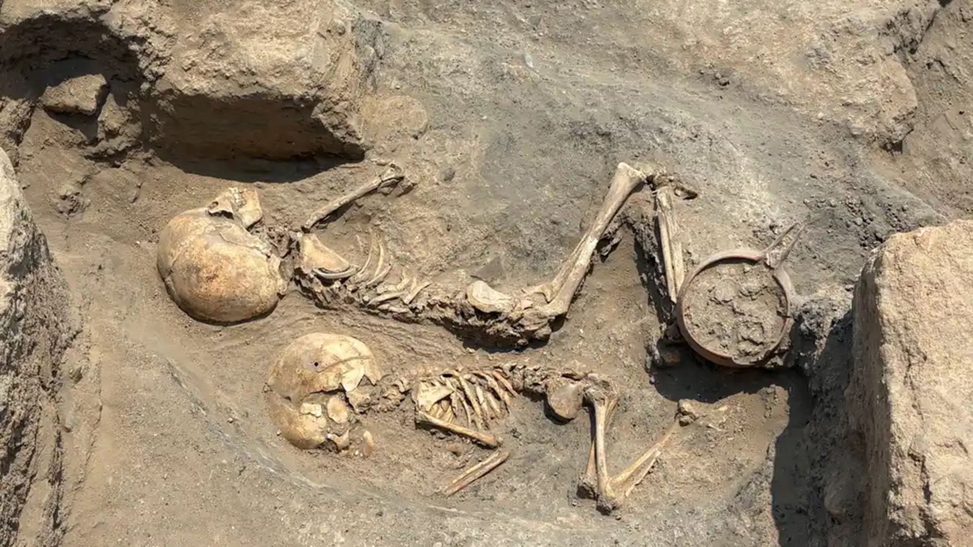 Cranial Surgery in the Bronze Age: Discovery of a 4,000-Year-Old Child's Skull in Uzbekistan