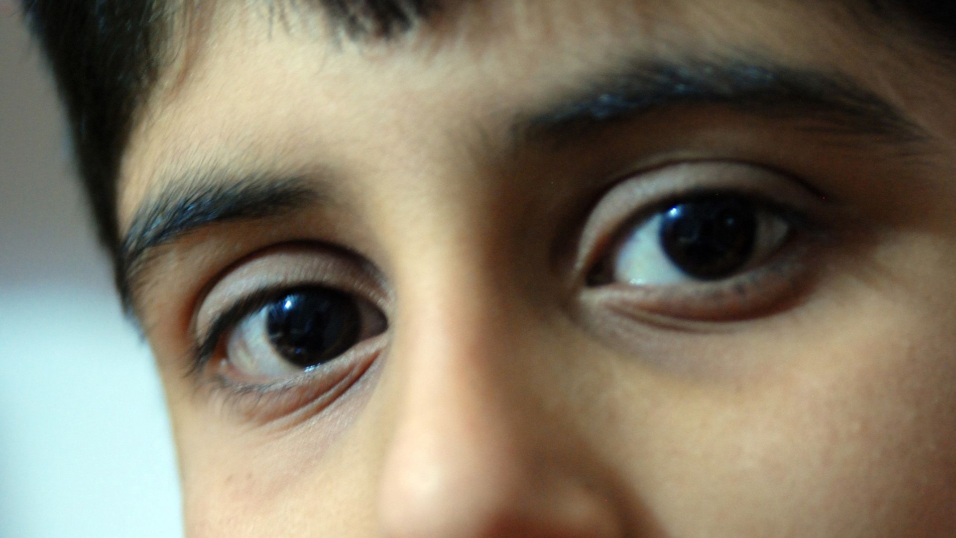 Um Dilema Diagnóstico: O Mistério do Sangue nos Olhos, Ouvidos e Nariz de um Menino