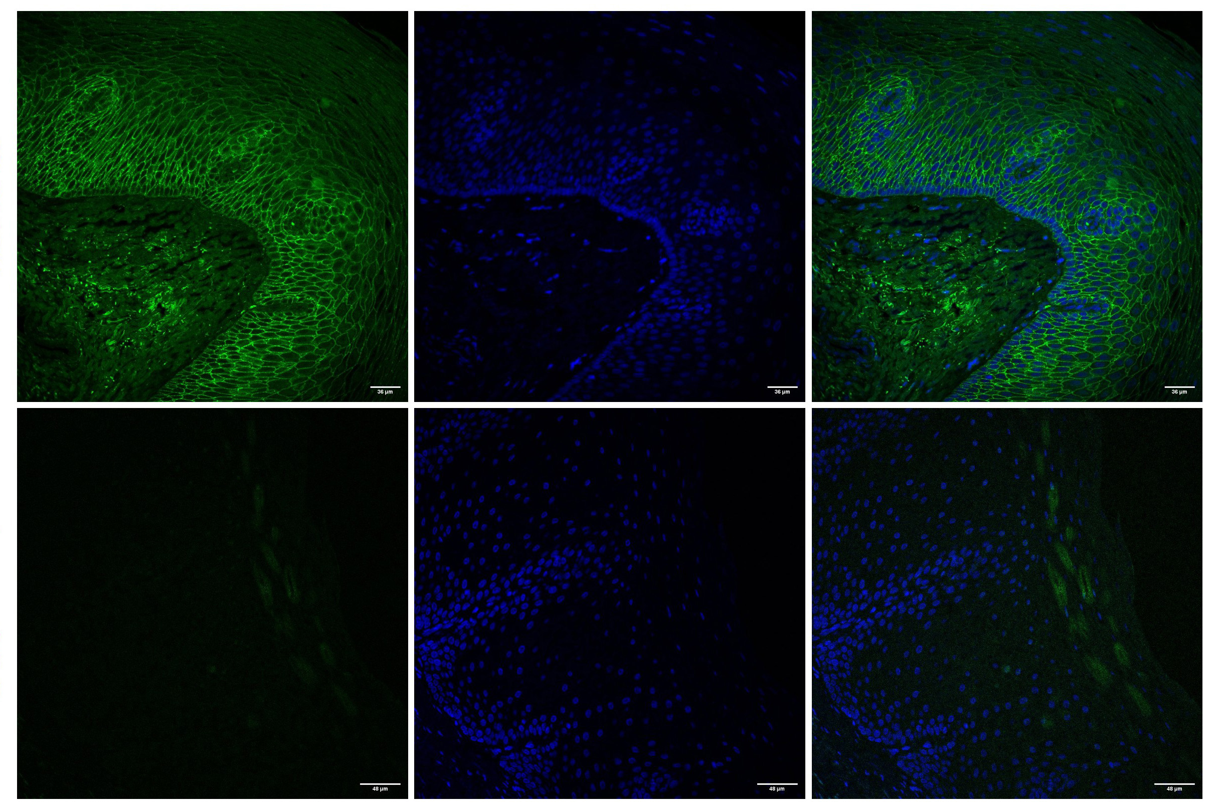 MIT Engineers Pioneering Direct Drug Delivery to the Esophagus