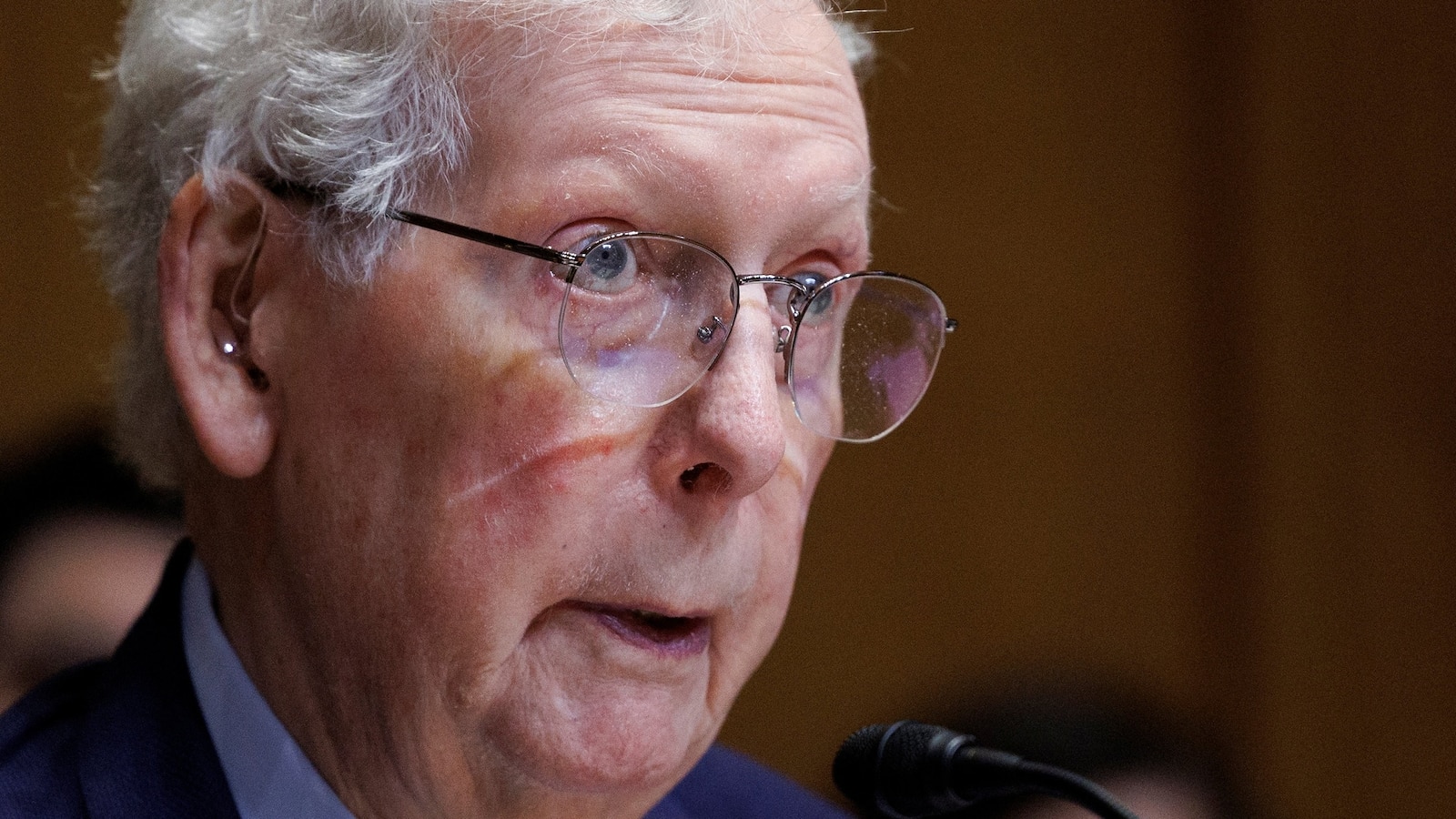 Senador Mitch McConnell Hospitalizado: Desafios de Saúde e o Futuro da Liderança Política
