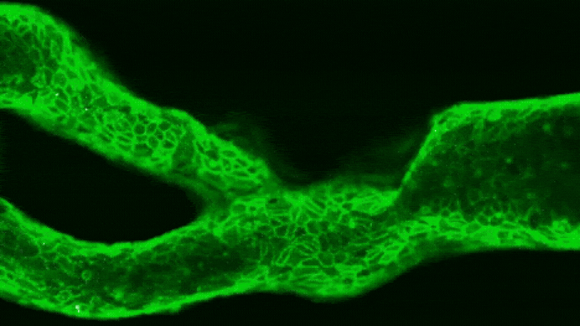 Mini 'Arteries-on-a-Chip' Podem Prever o Risco de Acidente Vascular Cerebral (AVC)